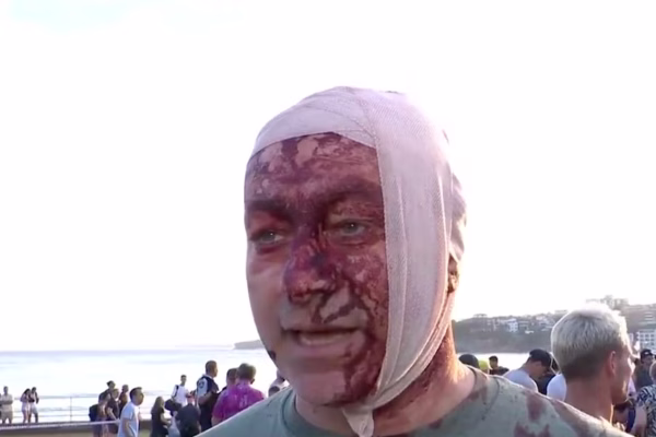 Witnesses, including antisemitism activist, describe ‘absolute bloodbath’ in Bondi Beach Hanukkah attack